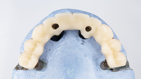 temporary dental prosthesis of the upper jaw on the model, taken from above on a white background