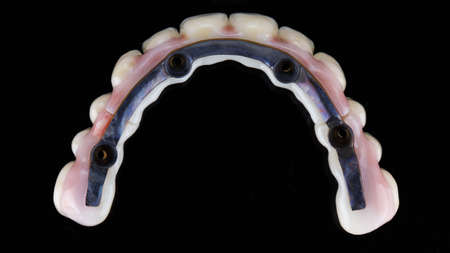 view of the bar in the prosthesis before shaping, top view on a black background
