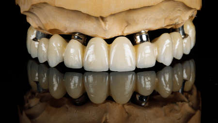 dental prosthesis of the upper jaw made of zirconium on black glass with reflection