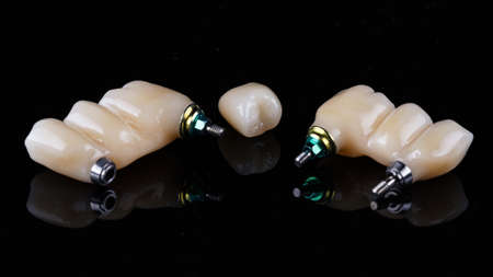 ceramic dental bridges and one crown on black glass