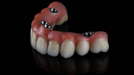 dental prosthesis made of ceramic and a beautiful pink gum. side view with reflection
