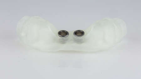 beautiful surgical dental template for implantation of central teeth on a white background