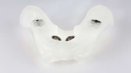 Surgery template for implantation of four implants on a white background