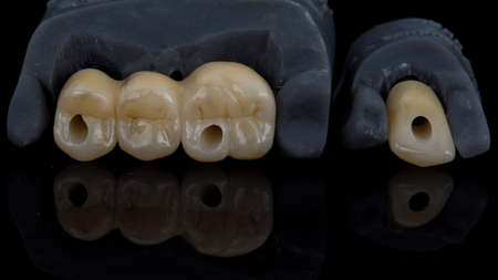 Dental crowns with zircon morphology on models, photo on black glass with reflectionの写真素材