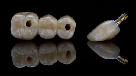 Composition Dental Bridge and one zircon crown on black glass with reflection