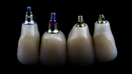 dental crowns and bolts of different colors for fixation, shot on a black backgroundの写真素材