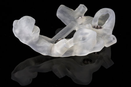 dental template resting on the patient's teeth for implantation, shot on a black background side...