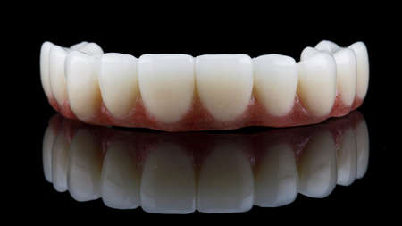 Dental prosthesis of the upper jaw with a pink gum, shot on a black background with reflection