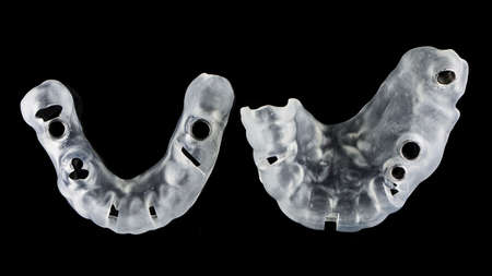 two dental surgical templates, top view on black backgroundの写真素材