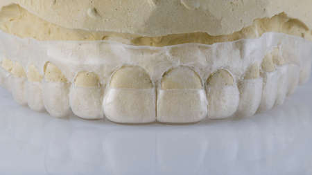 flexible dental cap for plastics of the upper jaw gums on a white background