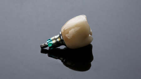 dental crown made of ceramic with orthopedic components on glass with reflectionの写真素材