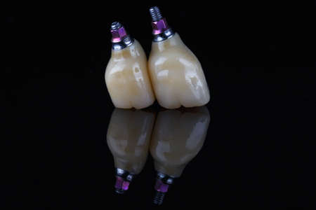 minimalistic composition of finished dental crowns made of ceramics and orthopedic components on a black backgroundの写真素材