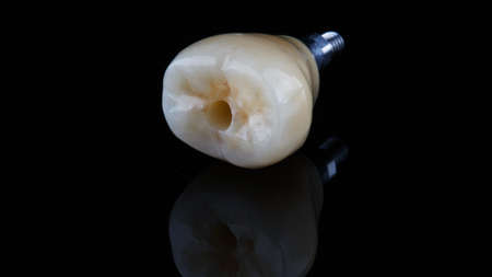 dental macro photo crowns from quality materials on a black backgroundの写真素材