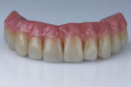 natural dental prosthesis with pink gum of the upper jaw, shot on a white background
