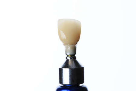 high quality dental crown on a white background