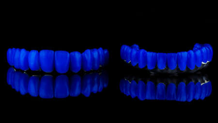 wax up on a titanium bar with blue wax teeth of the lower and upper jaws on black glass with a...
