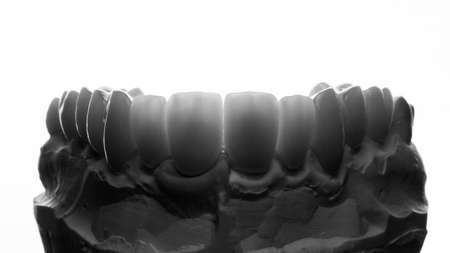 creative photo of dental veneers on the model of the upper jaw, photo in black and white style on a white backgroundの写真素材
