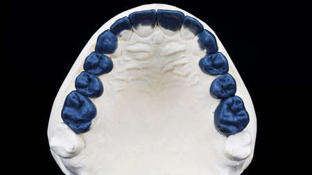 technical wax-up made of blue material of the upper jaw. top view of morphology