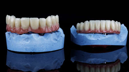two dental prostheses for two jaws with artificial gums on blue plaster modelsの写真素材