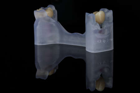 zirconia crowns on a resin model, shot against a black background