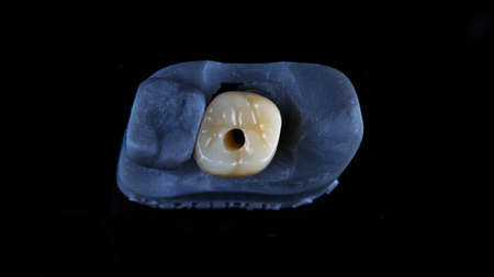 ceramic crown on a model on a black background, top view
