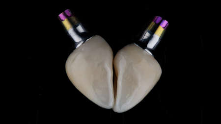 two dental crowns made of ceramic, folded in the form of a heart on a black backgroundの写真素材