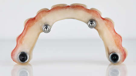 excellent photo on the dental prosthesis of the upper jaw, the arch was shot on a white background with reflectionの写真素材