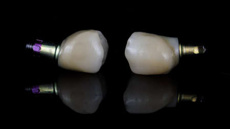 composition of dental crowns and prosthetics for fixation in the gum cavityの写真素材