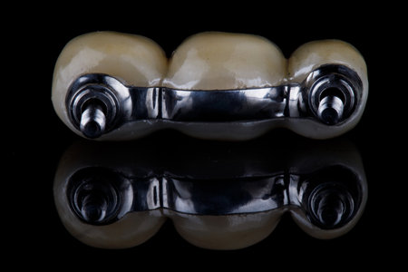 titanium dental bar with three teeth bridge on black backgroundの写真素材
