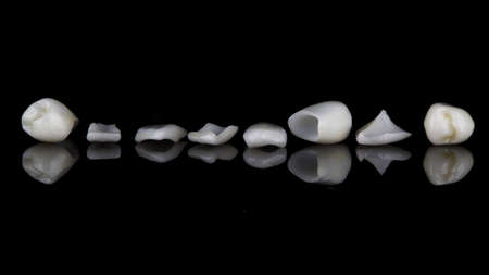 macro photo of thin ceramic veneers on black glass with creative reflectionの写真素材