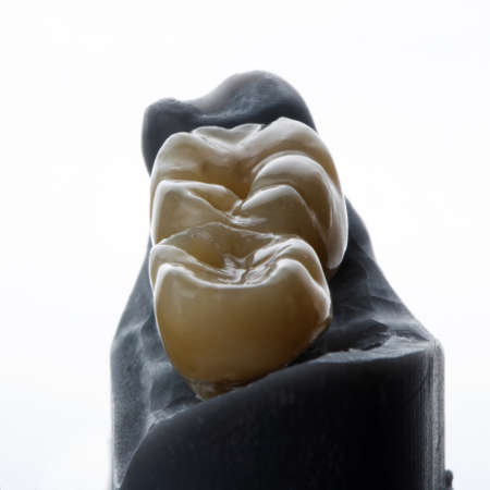 beautiful crown morphology with beautiful lightingの写真素材