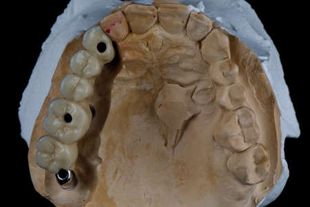 ceramic ceramic bridge on the model
