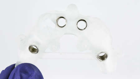 a doctor in a glove holds a surgical template for the implantation of four implants, filmed on a...