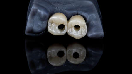 dental crown made of zircon on resin model, shot on black glass with reflection