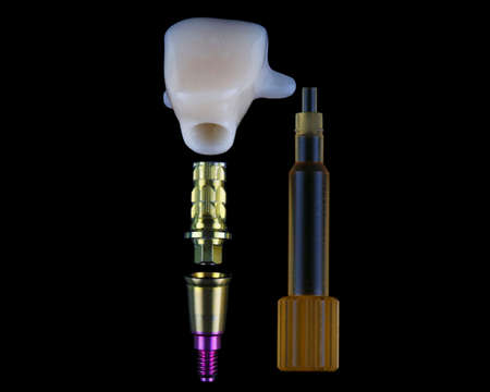 high-tech components for dental implantation along with a crown