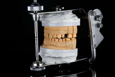 articulator and bite model for ceramic tabs