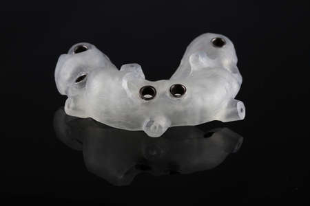 Dental template from polymer after implantation on a black background