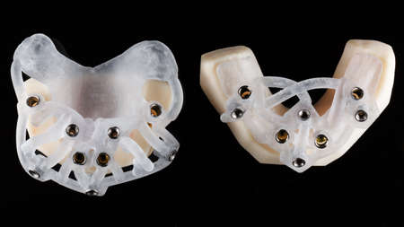 two high-quality surgical templates on 3D printer models, shot from above on black glassの写真素材
