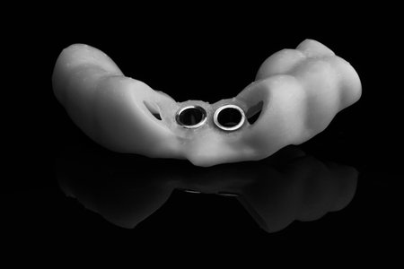 Dental template on black glass with reflection, shot in black and white style