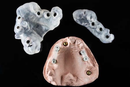 two surgical templates for implantation and a model on black glass, shot from above