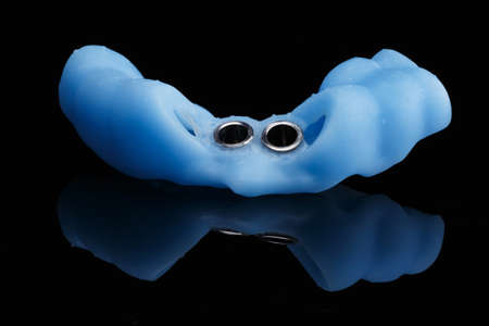 special dental pattern on black glass with reflection
