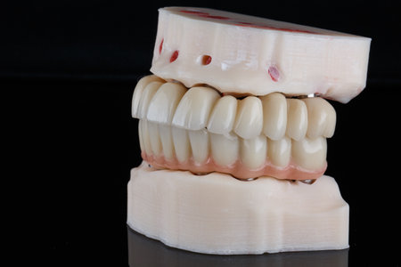 dental model with prostheses of both jaws on a black background