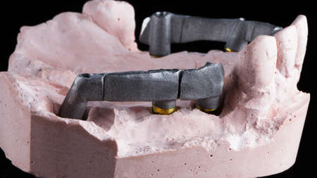 small dental beams from the site for implantation and prosthetics in the chewing parts of the jaw