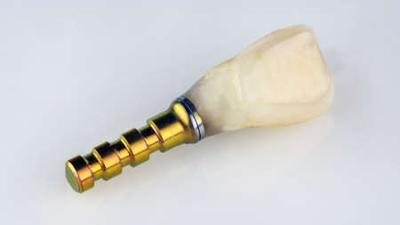 finished crown from a natural tooth of the patient and the components to set the gold color on a...