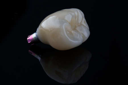 excellent dental macro photo of high quality crown, shot on black glass with reflection