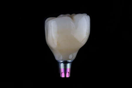 excellent dental macro photo of the patient ready for installation