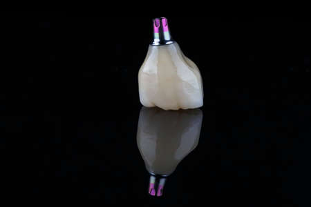 high quality crown for chewing part of jaw after implantation