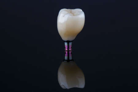 Dental macro photo of high quality crown, on black glass with reflectionの写真素材