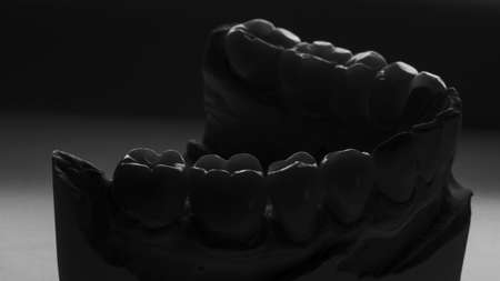 creative photo of dental crowns on a model in black and white styleの写真素材