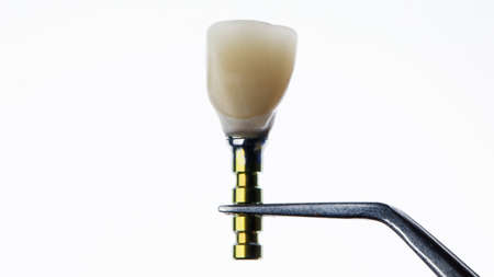 dental crown after modeling on the transfer, before installation to the patient